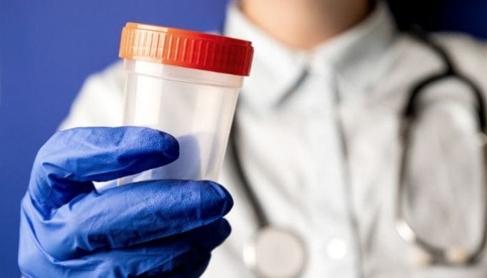 Common Misconceptions About Drug Testing