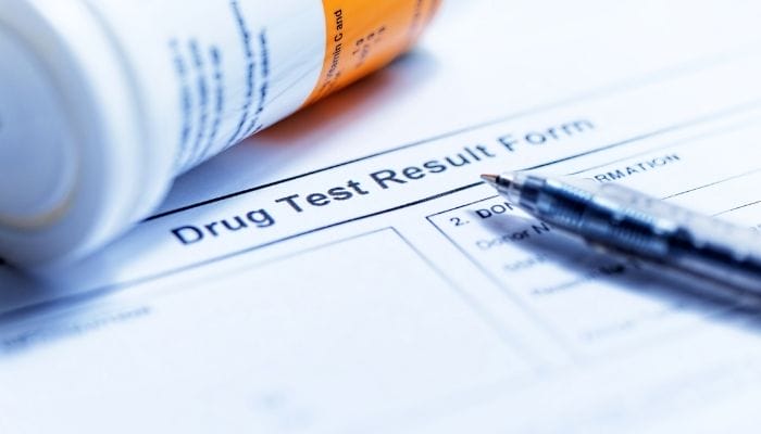 What You Need To Know Before Your Drug Test